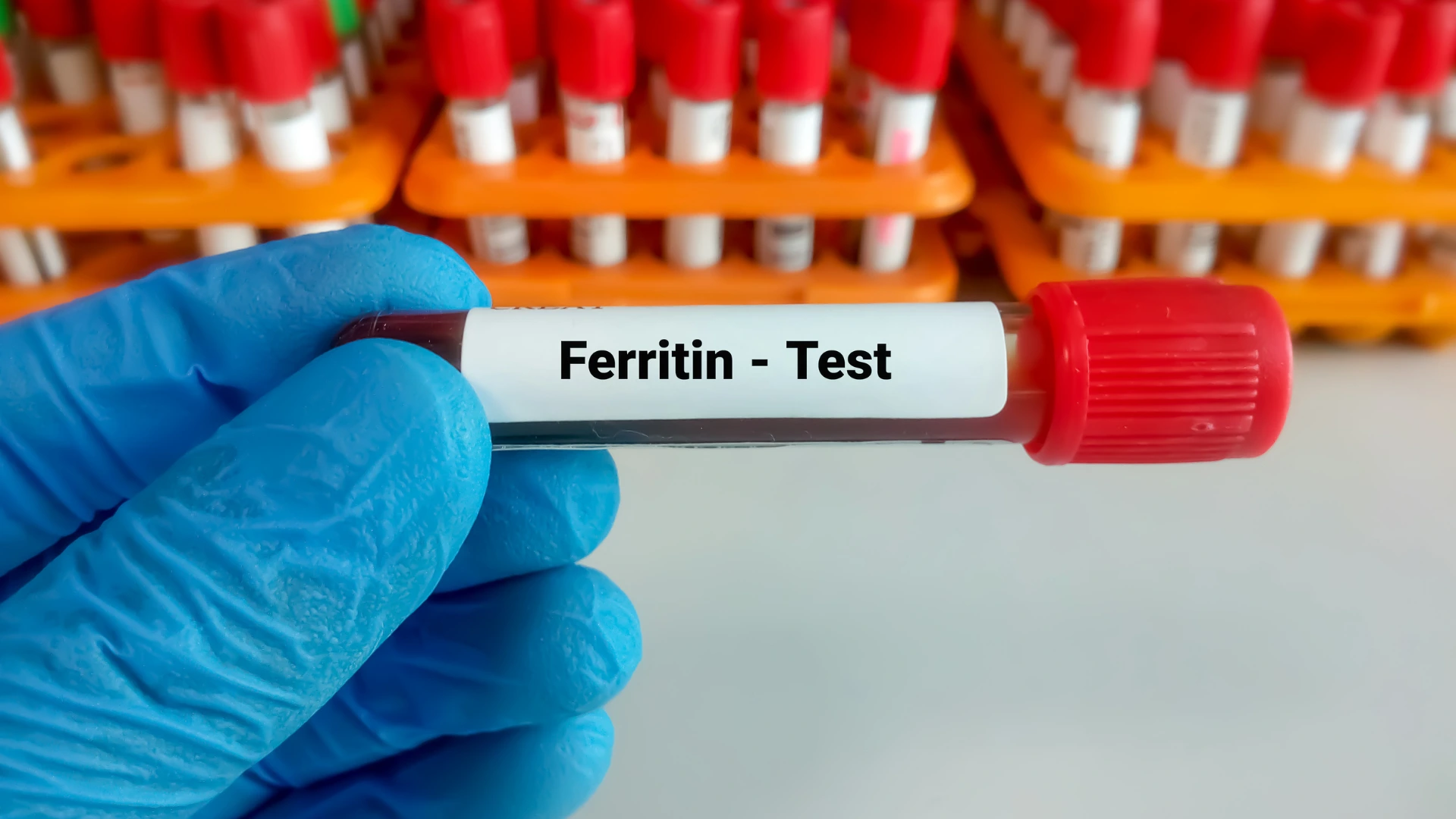 Ferritin - Test
